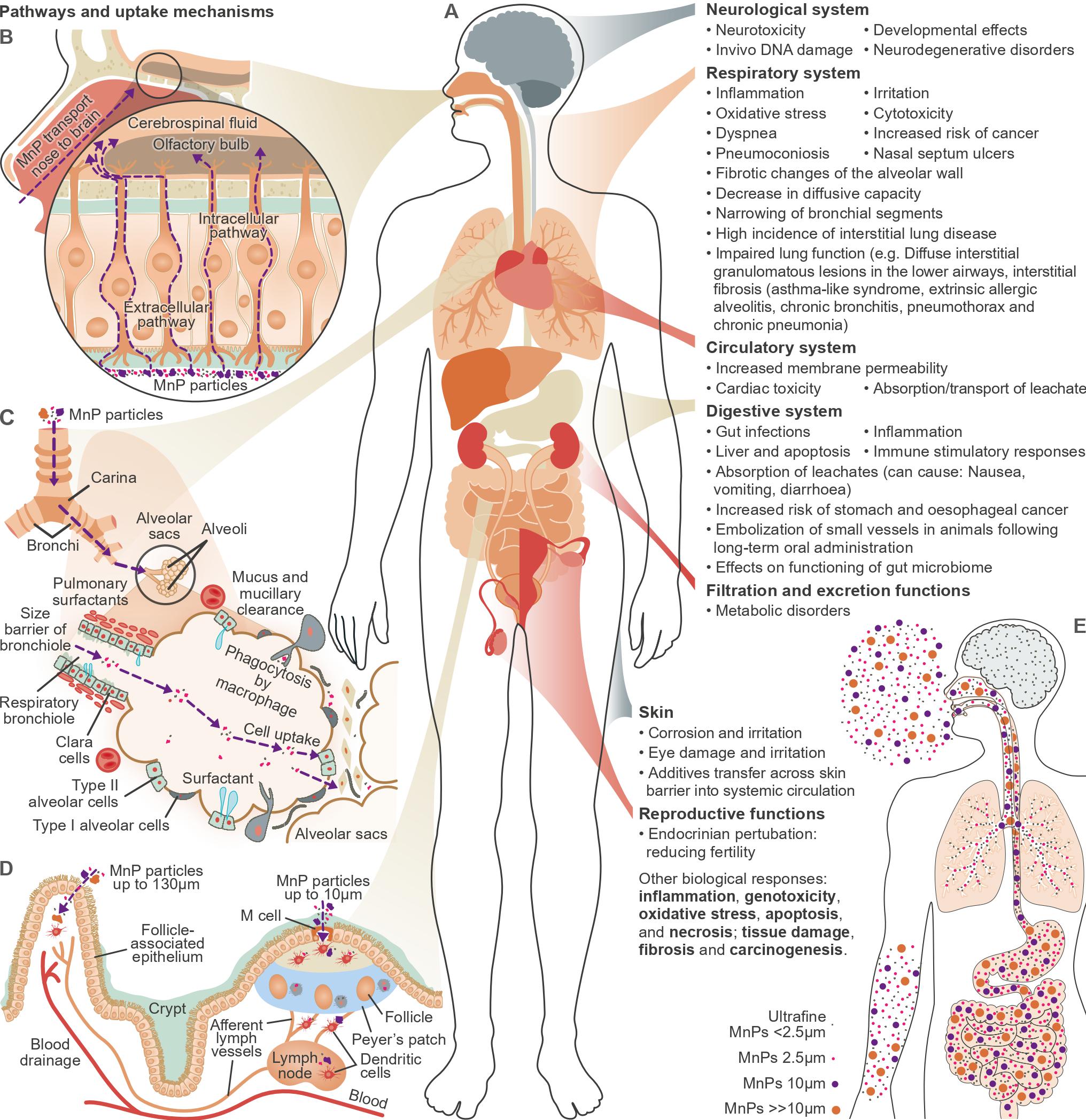 Hypothesized uptake mechanisms of MnPs through human body (A–D) (A) Hypothesized uptake mechanisms of MnPs through human biological barriers, including via (B) the olfactory bulb, (C) the lung-air barrier, and (D) the gastrointestinal tract, indicating also the systems and organs directly affected by MnPs and the associated MnP impacts and suspected adverse health out comes including NCDs. The suspected particle-size fractionation caused by differences in the uptake mechanisms (A–D) is highlighted in (E), with larger particles being ingested (up to 130 mm) rather than inhaled (%2.5 mm) and only the smallest (nanoscale) particles being able to penetrate the blood-brain barrier. MnP internalized by routes (C) and (D) reach the wider circulatory system and from there can reach all organs.